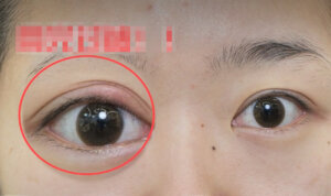 eyelash sensitive glue What Is The Growth Cycle of Eyelashes – OUR LASH